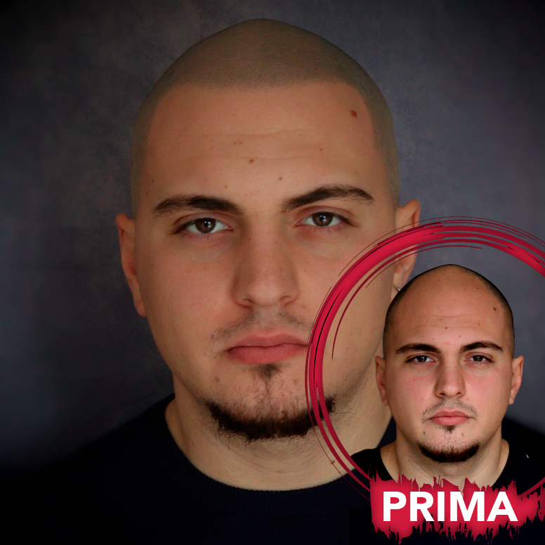 tricopigmentazione